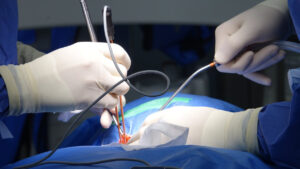 braided vs monofilament suture