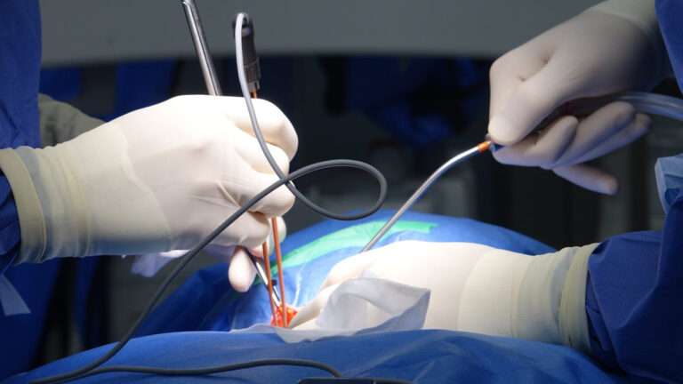 braided vs monofilament suture