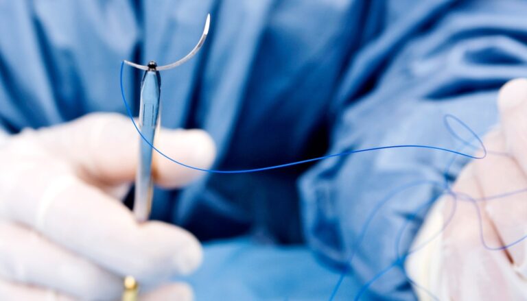 do barbed sutures dissolve