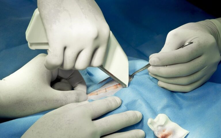how do skin staples work
