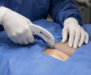 disposable skin stapler