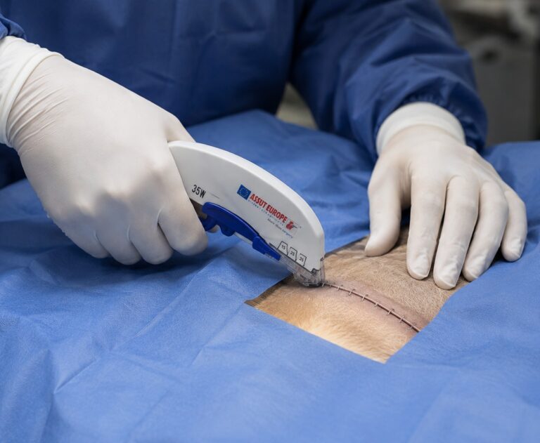 disposable skin stapler
