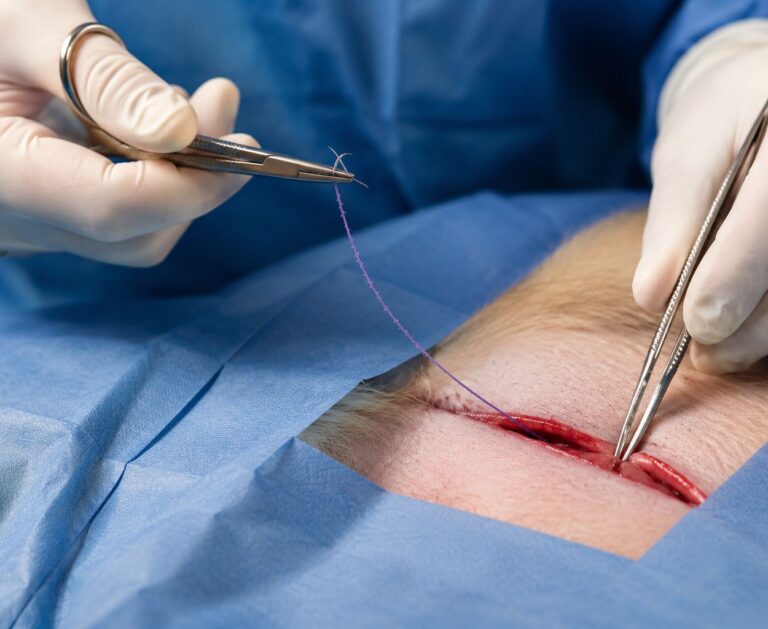 knotless barbed sutures