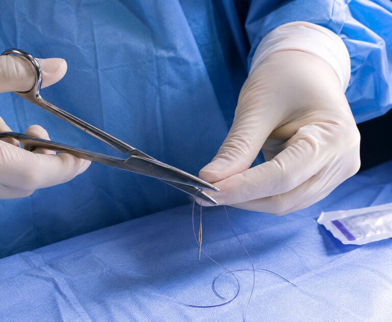 suture material length