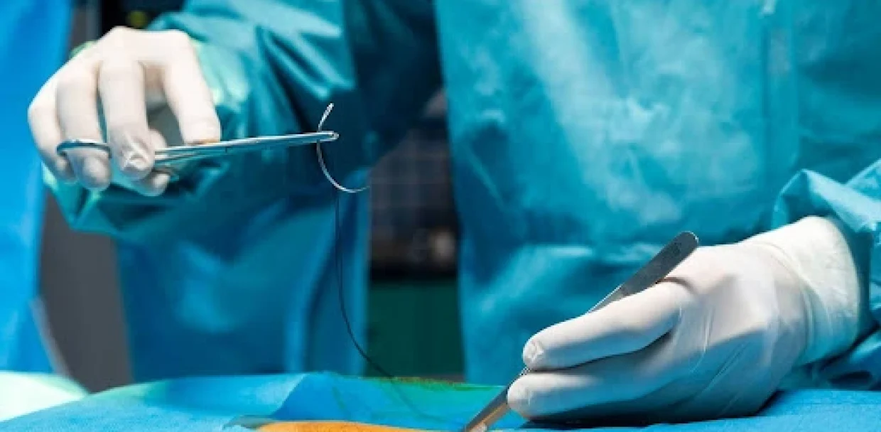 advantages of absorbable and non absorbable sutures