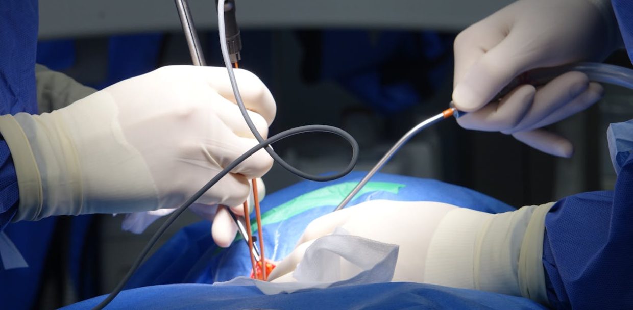 braided vs monofilament suture