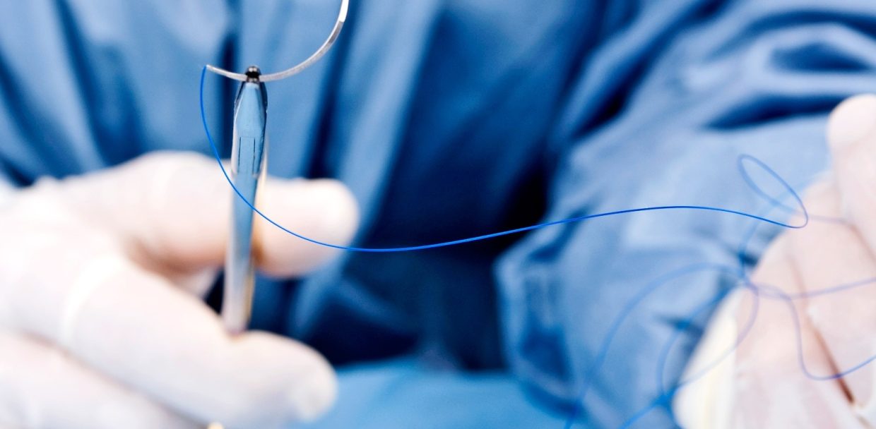 do barbed sutures dissolve
