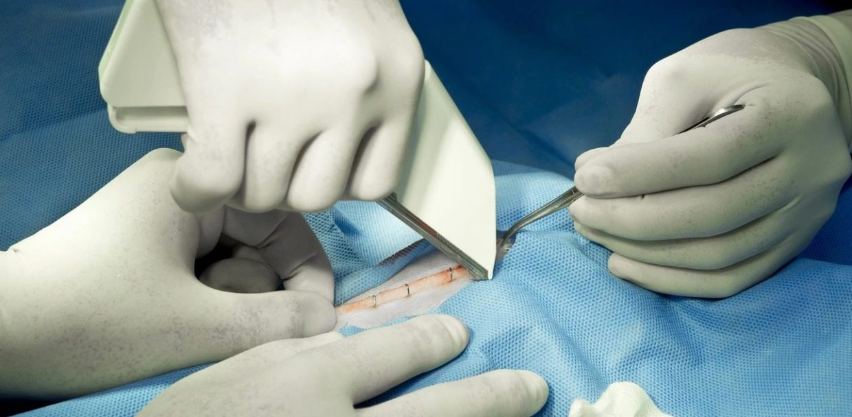 how do skin staples work