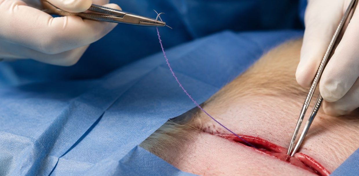 knotless barbed sutures