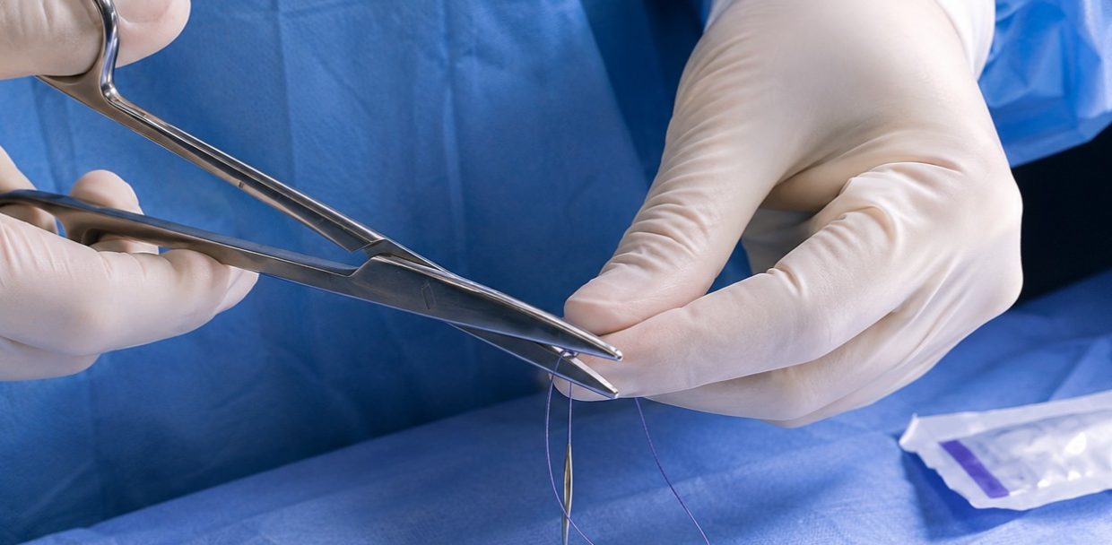 suture material length